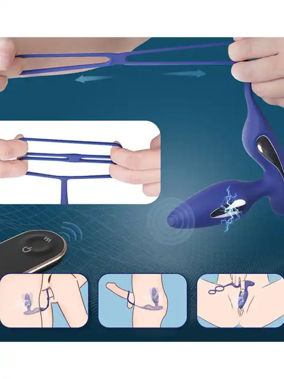 #9422 - Penis Halkalı Prostat ve Elektro Şok Özellikli Anal Vibratör